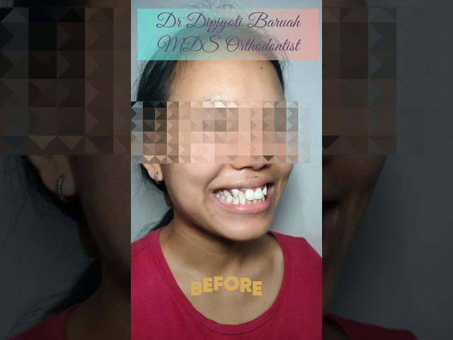 Thumbnail for Post ID: 3sQe0xgast0