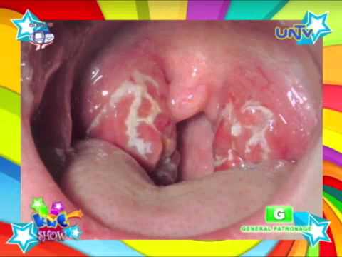 Kung magkano ang maaari kang mawalan ng timbang para sa 9 linggo Paano alisin tiyan taba at panig sa nakaraang buwan