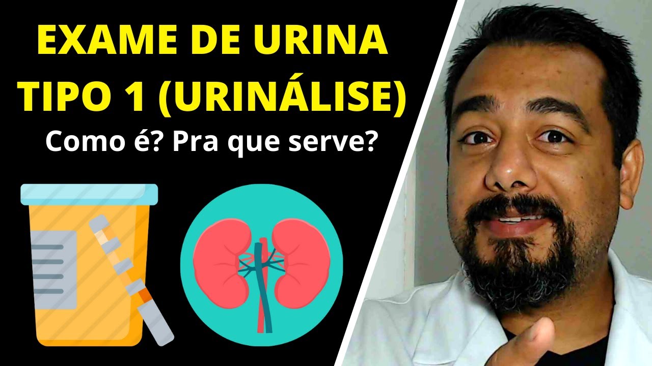 Exame de Urina Tipo 1 | Urinálise | Sedimentoscopia | EAS | Sumário | IBAP Cursos