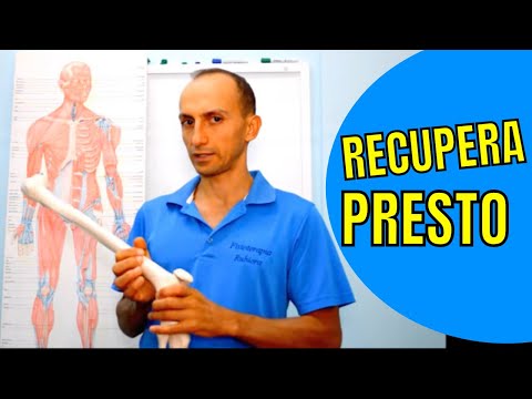 Patellar Fracture, How It Manifests