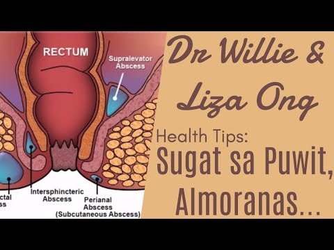 Kung paano alisin ang taba mula sa mga arm at laylay kamay Dzhigan mawala ang timbang Video