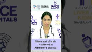 Which part of brain is affected in Alzheimer