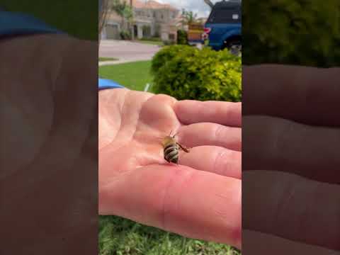 Bee stings happen on the daily