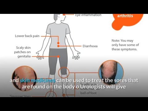 Térd chlamydialis arthritis, aki kezeli