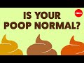 What Your Poop Can Tell You About Your Health Hannibal Person