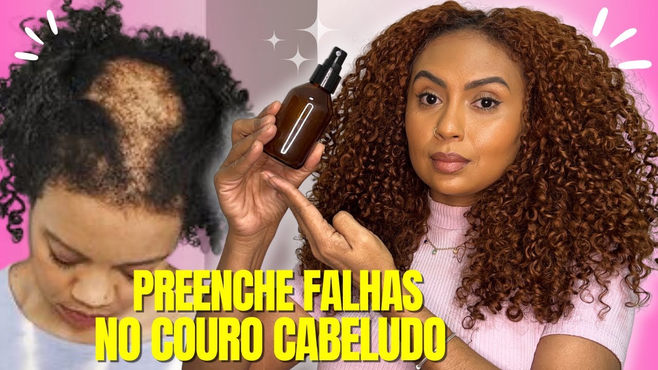 TÔNICO NATURAL CRESCIMENTO CAPILAR CURA CALVÍCIE E QUEDA CAPILAR