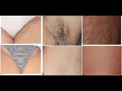 download lagu mp3 mp4 Average Cost Of Laser Hair Removal In India, download lagu Average Cost Of Laser Hair Removal In India gratis, unduh video klip Average Cost Of Laser Hair Removal In India