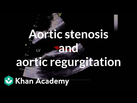 Aortic stenosis and aortic regurgitation | Circulatory System and Disease | NCLEX-RN | Khan Academy