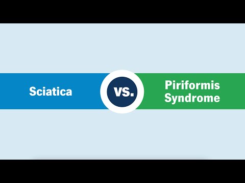Sciatica vs. Piriformis Syndrome: What’s the Difference?