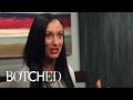 Melissa S 700cc Implants Are Weighing Her Down Botched E