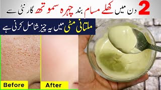 Home Remedies To Get Rid Of Open Pores On Skin || Shrink large pores Naturally At Home