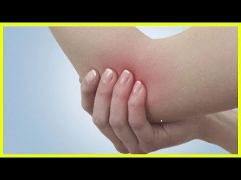Physikalische Therapie für Hüfte für ein Kind 3 Jahre Anzeichen für eine Bursitis des Kniegelenks synovitis