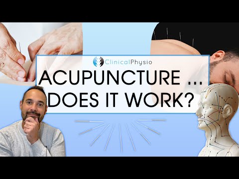 Does Acupuncture Work in Physiotherapy?! | Expert Physio Reviews the Evidence