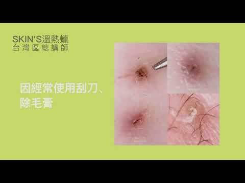 【第五集】除毛學科