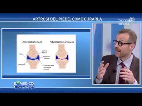 Dolore al ginocchio appena Come alleviare il dolore al collo da dietro