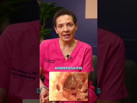 What Does It Mean if Your Stool Is Pencil Thin?🤔 #shorts #drritha