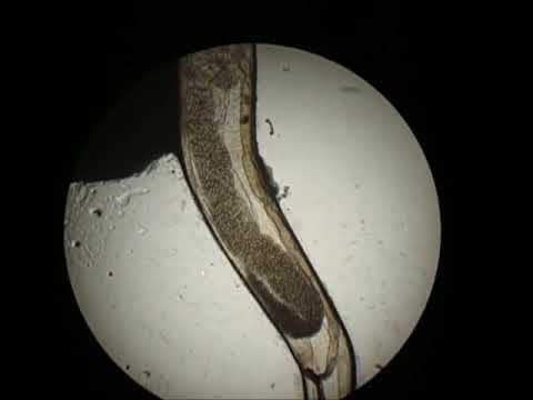 Chilocaloria di uovo di helminths protozoa Video di vermi di pinworms