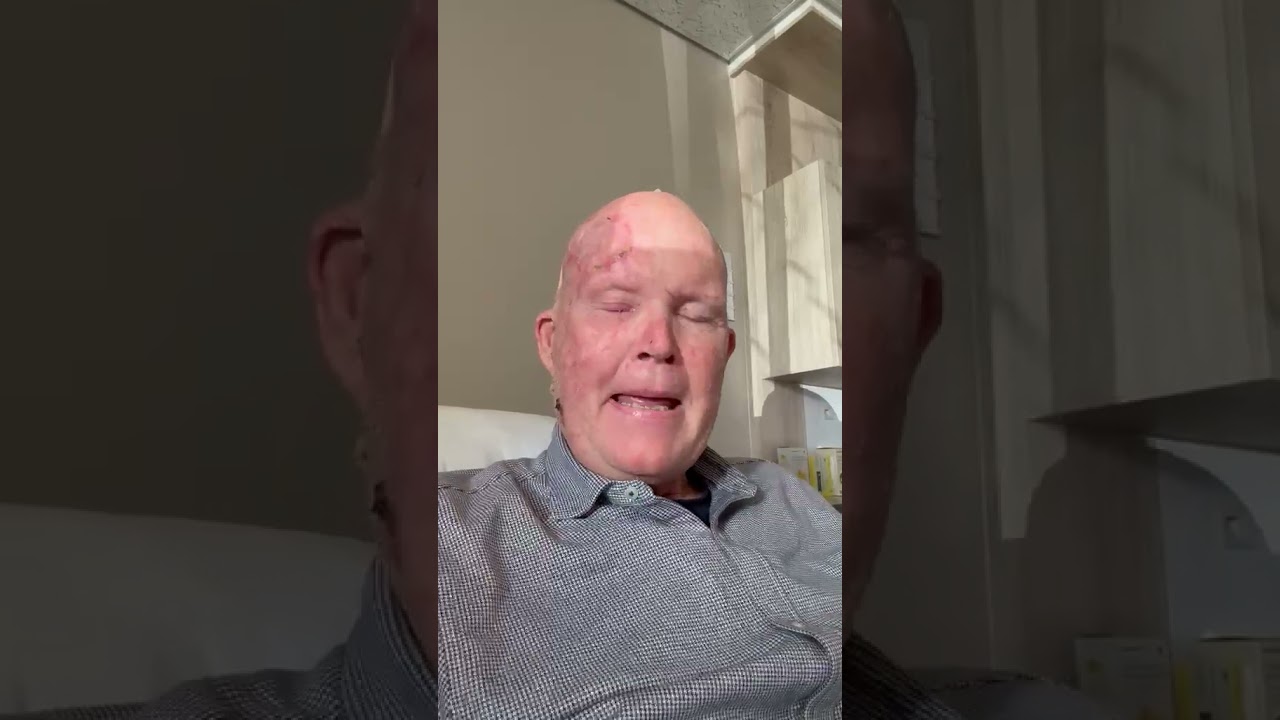 Oscar Chalupsky Health Update 20 July 26