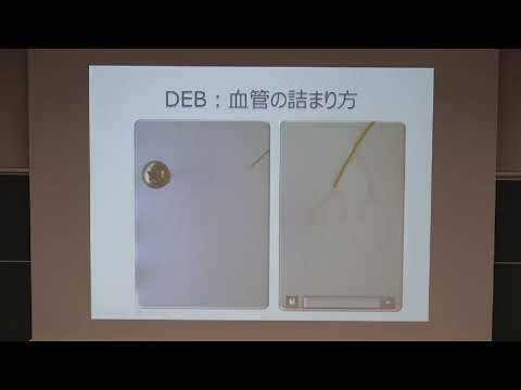 看護学科 【兵庫医科大学】模擬授業「がんの新しい治療：IVRという選択」(医学部 OPEN CAMPUS 2021)