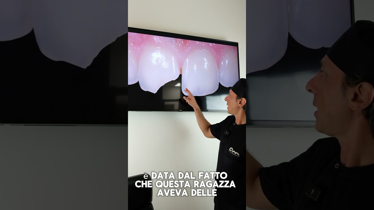 Odontoiatria conservativa