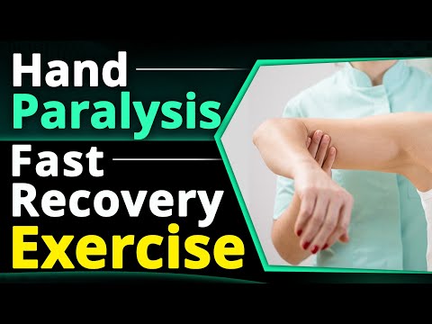Hand Paralysis Fast Recovery Exercises | After Paralysis Hand Exercises | Dr. Pragti Gupta