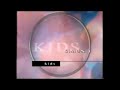 SABC 1 Kids Ident 2001 2003 Simunye