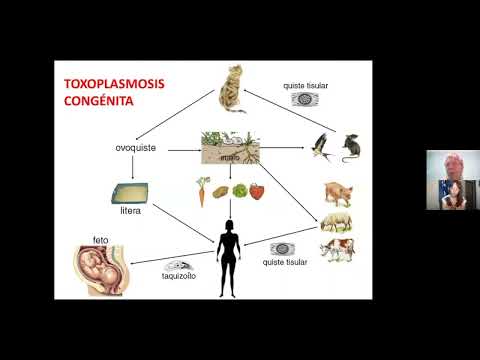 Toxoplasmosis Congénita