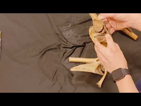 Das Schultergelenk: Art. humeri - Anatomie kurz und knackig!