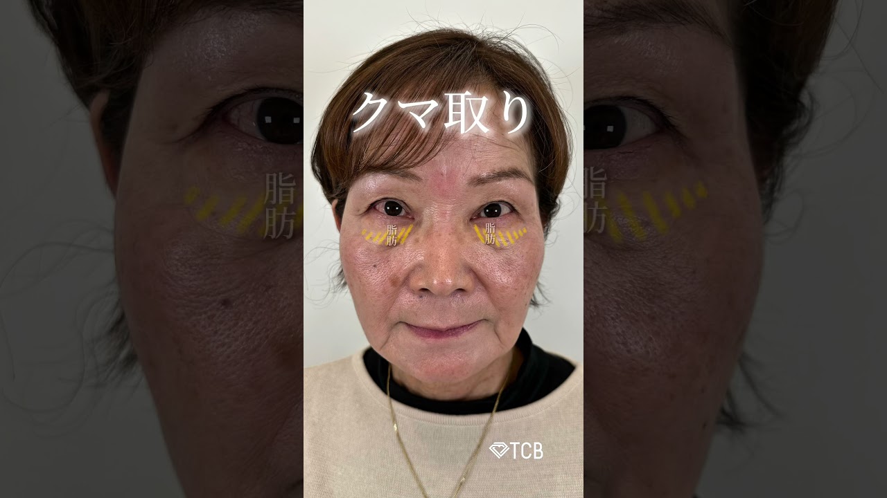 Youtubeのサムネイル