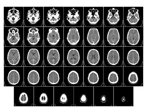 Images: Generalities.