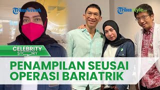 Penampilan Melly Goeslaw seusai Jalani Operasi Bariatrik Bikin Pangling, Sebut BB Turun 12 Kg