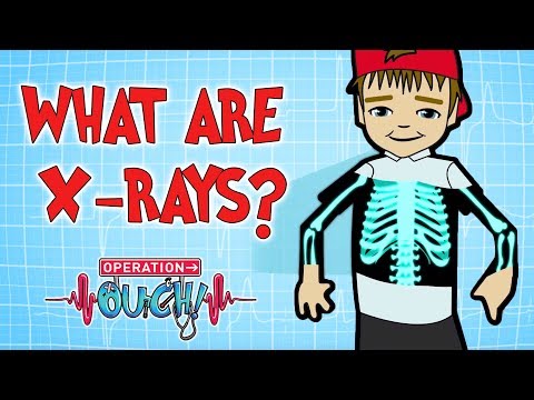 How do X-Rays Work? | Broken Bones | Operation Ouch
