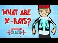 How Do X Rays Work Broken Bones Operation Ouch