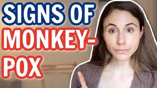MONKEYPOX OUTBREAK: SIGNS & SYMPTOMS NOT TO MISS 😮 DERMATOLOGIST @Dr Dray