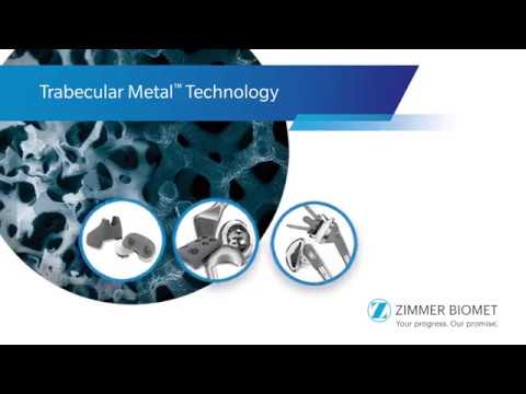 Trabecular Metal Technology