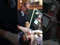 Dr Geaccone Does Patients Teeth Fillings With Fotana Laser