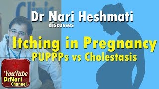 Itching in Pregnancy: PUPPPs vs Cholestasis of Pregnancy Discussed by Dr Nari Heshmati