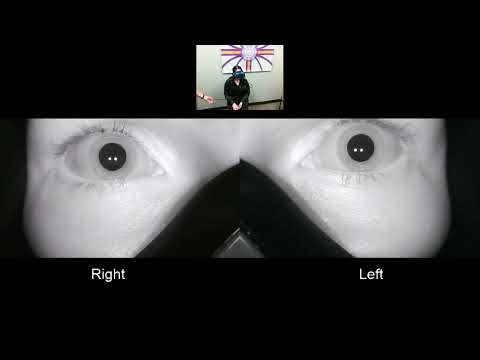 Nystagmus After Spinning