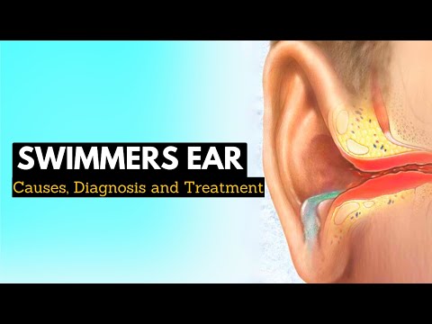 Meniere s disease Everything You Need to Know