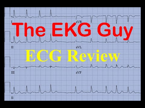 EKG/ECG - Cardiac Anatomy and Circulation 2.0 | The EKG Guy - EKG.MD