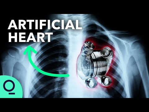 image-How long did Barney Clark live with his artificial heart?