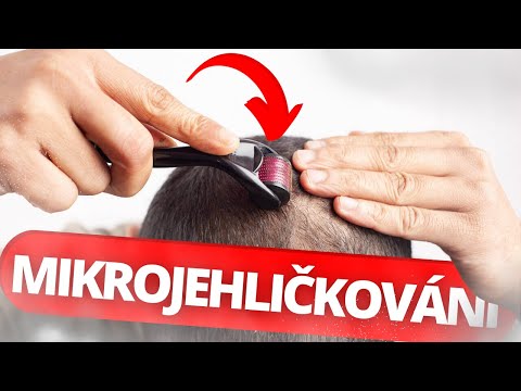 Proč Si Píchám Do Hlavy Tisíce Malých Jehliček | BENEFITY MIKROJEHLIČKOVÁNÍ