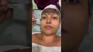 Download lagu Carbon laser with Chandhini Prakash | instant Detan #trending #love #youtubeshorts #viral #skincare mp3