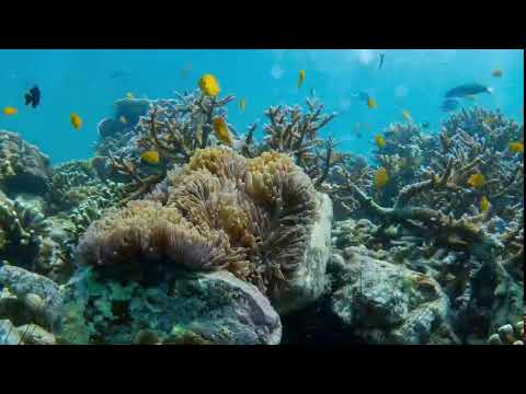 It is often the small steps, not the giant leaps, that bring about the most lasting change.