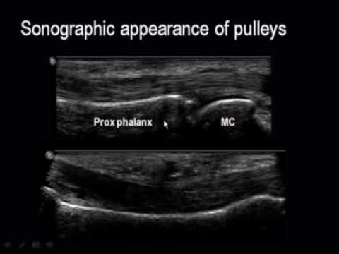 Hand & Wrist Sonography