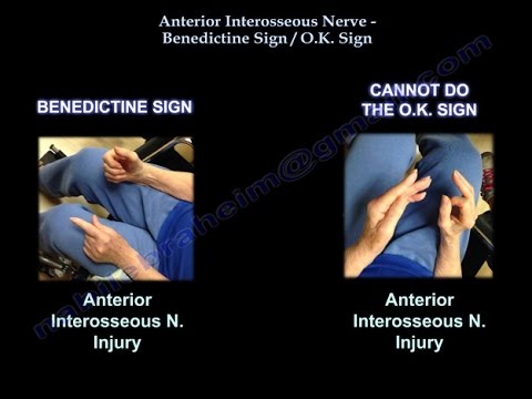 Anterior Interosseous nerve,  O K  Sign - Everything You Need To Know - Dr. Nabil Ebraheim