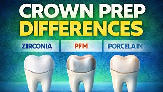 Zirconia vs PFM vs Porcelain Crown Prep | NDECC™ & ADC Guide