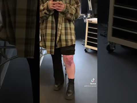 getting a knee tattoo