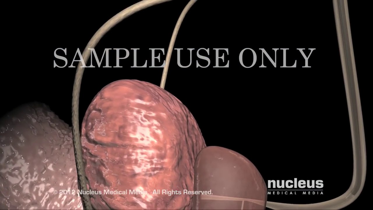 Roberto Carlos Castañeda Caballero-24