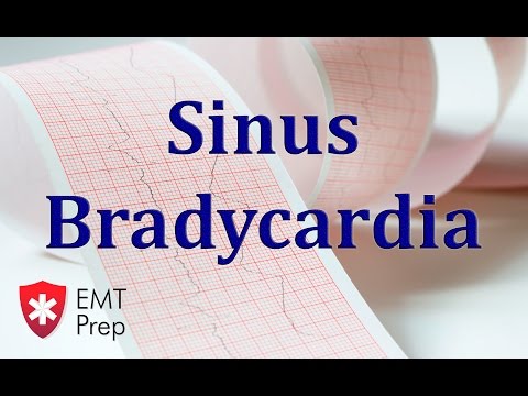 Sinus Bradycardia ECG - EMTprep.com